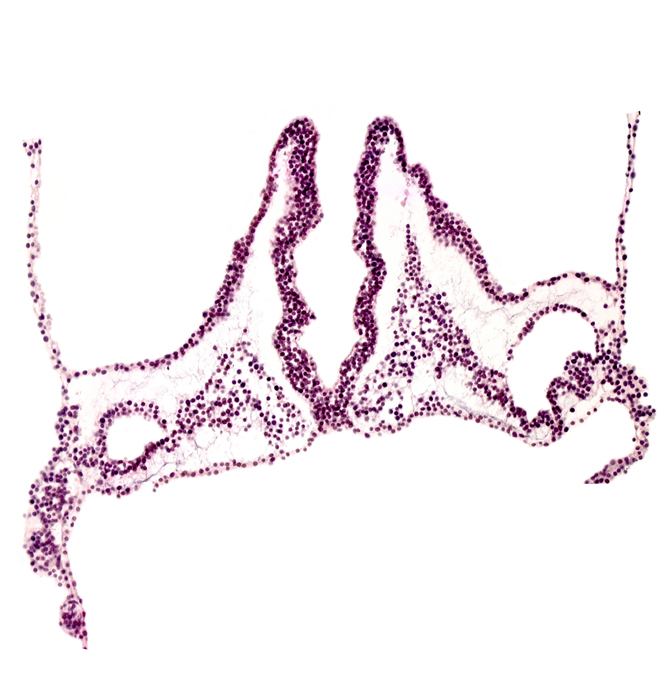 hemangioblastic tissue, midgut primordium (lumen), primordial otic placode, primordial right dorsal aorta, rhombomere A (Rh. A), rhombomere B (Rh. B), rhombomere C (Rh. C), right vitelline (omphalomesenteric) artery, right vitelline (omphalomesenteric) vein