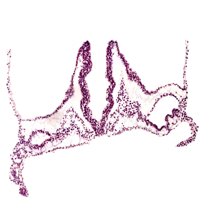 extra-embryonic mesoderm, head mesenchyme, hemangioblastic tissue, notochordal plate, primordial otic placode, primordial right dorsal aorta, rhombomere A (Rh. A), rhombomere B (Rh. B), rhombomere C (Rh. C)