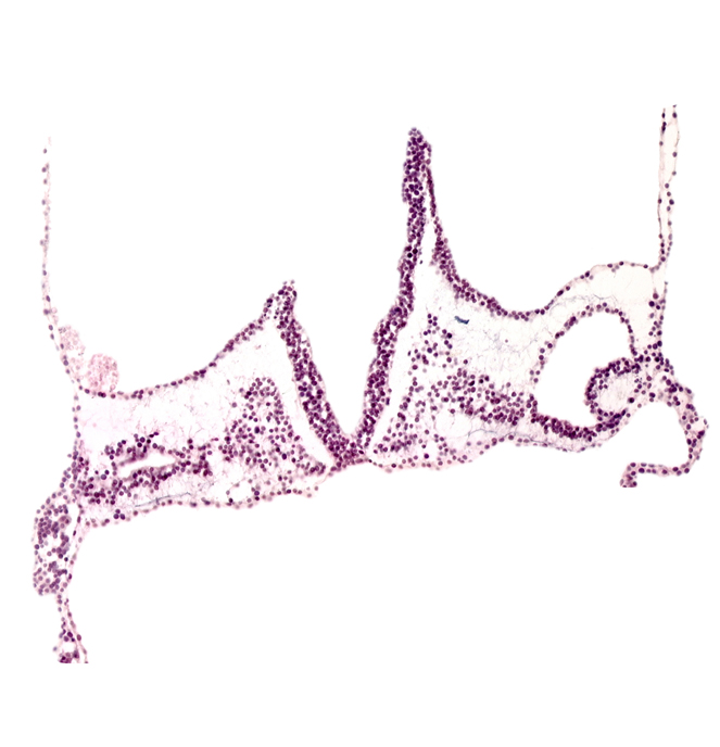 head mesenchyme, primordial left dorsal aorta, primordial otic placode, primordial right dorsal aorta, rhombomere A (Rh. A), rhombomere B (Rh. B), rhombomere C (Rh. C), right vitelline (omphalomesenteric) vein, surface ectoderm