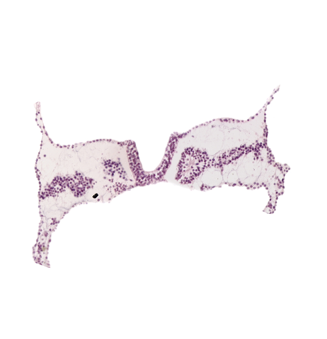 amnion attachment, caudal edge of somite 4 (O-4), endoderm, notochordal plate, somite 4 (O-4), surface ectoderm, umbilical vesicle attachment