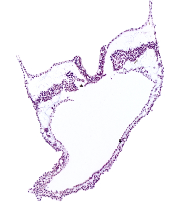 artifact separation(s), left vitelline (omphalomesenteric) artery, notochordal plate, primordial left dorsal aorta, spinal cord primordium, umbilical vesicle attachment