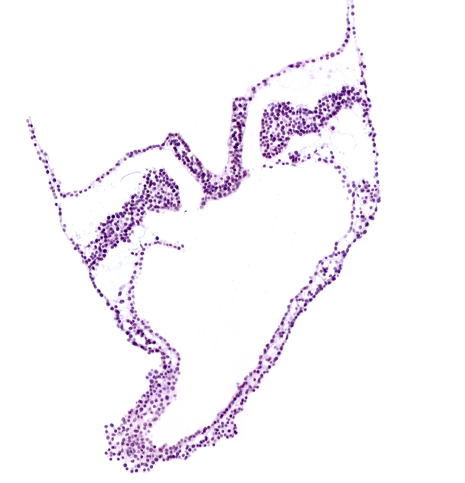 intermediate mesenchyme, lateral plate mesoderm, notochordal plate, paraxial mesoderm, umbilical vesicle attachment