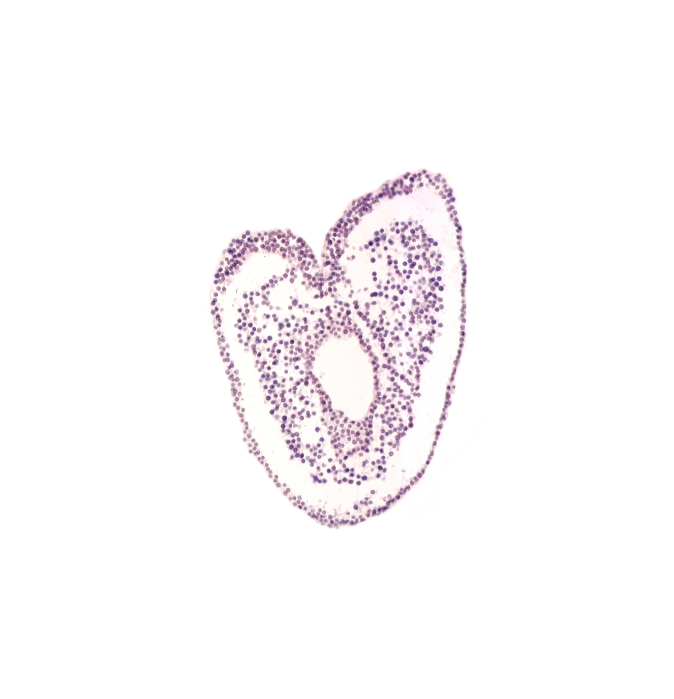 gastrulation (primitive) groove, hindgut primordium (lumen), junction of umbilical arteries, right umbilical vein