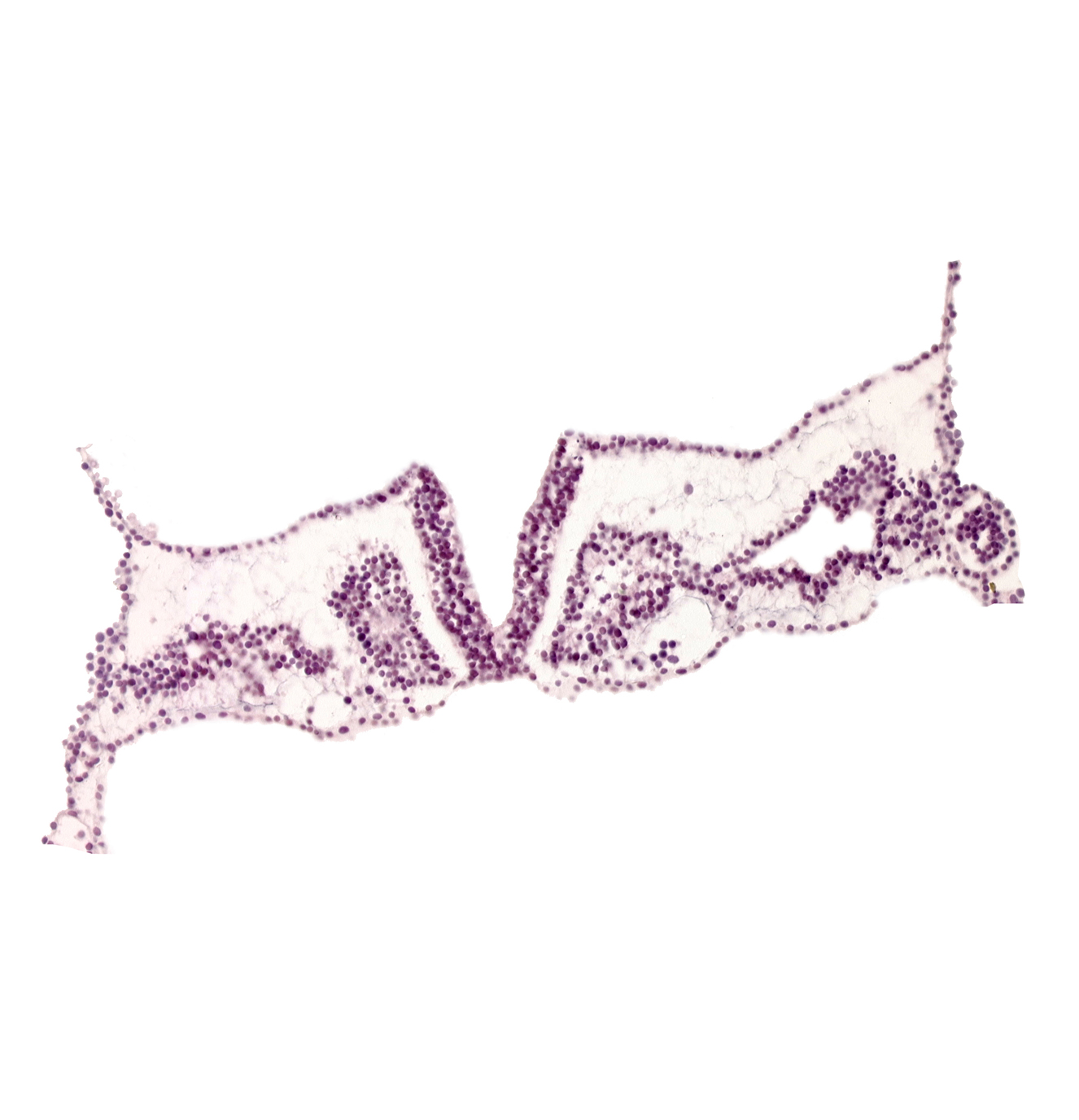 endoderm, mesoderm, midgut primordium (lumen), rhombomere D (Rh. D), somite 1 (O-1), somitocoel 1, surface ectoderm