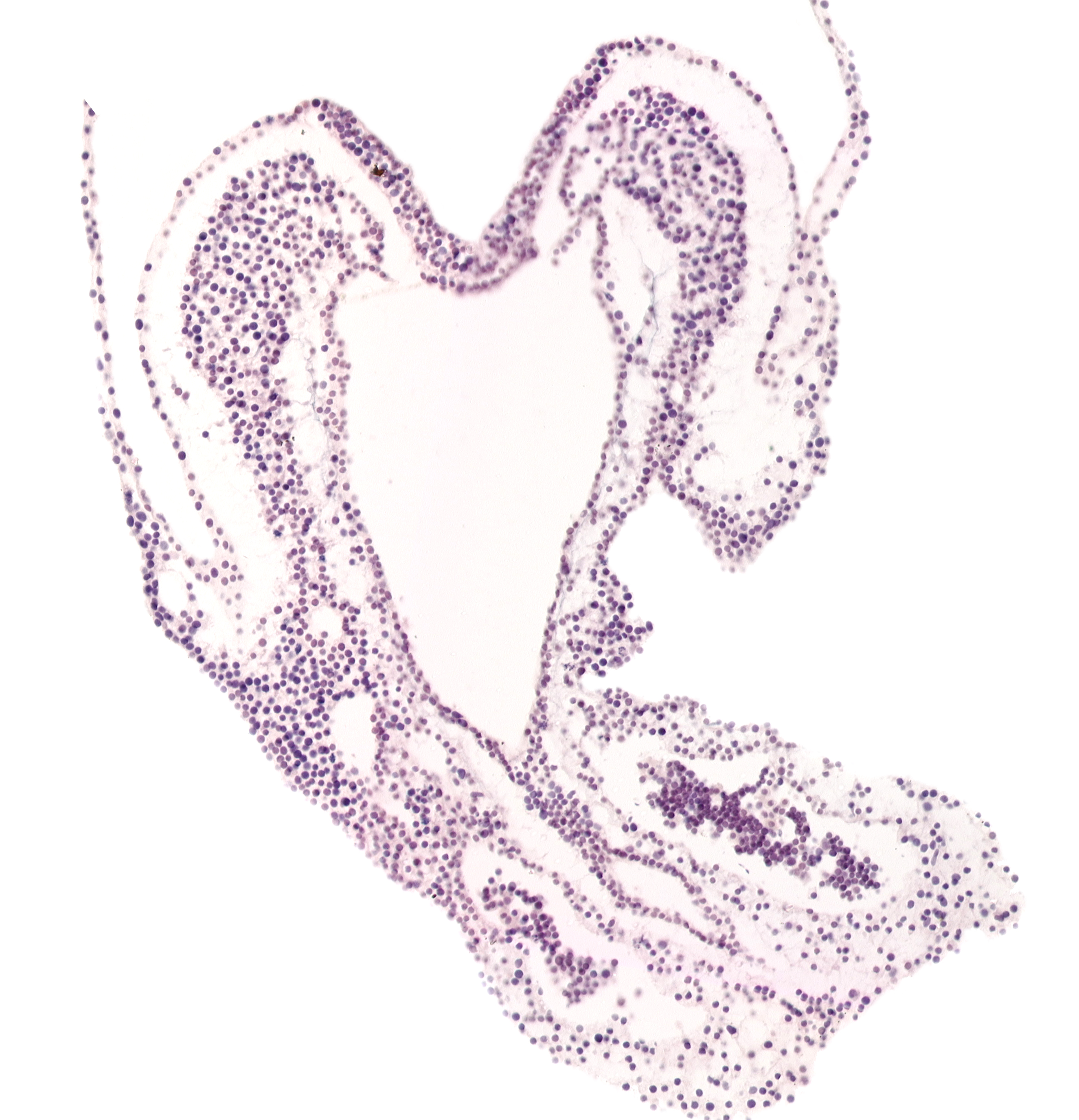 allantoic diverticulum, hindgut primordium (lumen), junction of allantoic diverticulum and hindgut, left umbilical artery, right umbilical artery