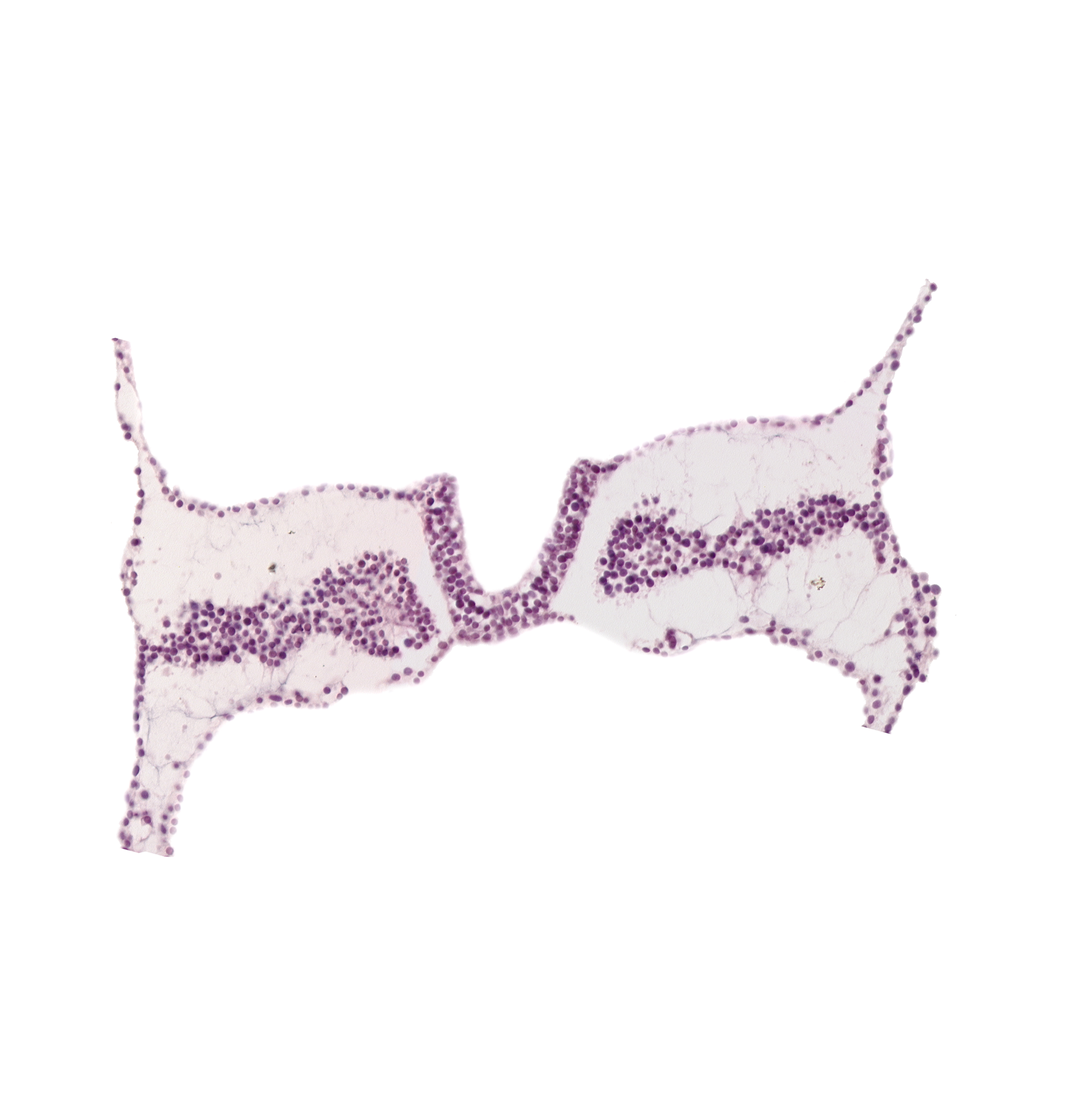 caudal edge of somite 4 (O-4), caudal part of rhombencephalon primordium (R), endoderm, lateral plate mesoderm, midgut primordium (lumen), notochordal plate, rhombomere D (Rh. D), surface ectoderm, umbilical vesicle cavity