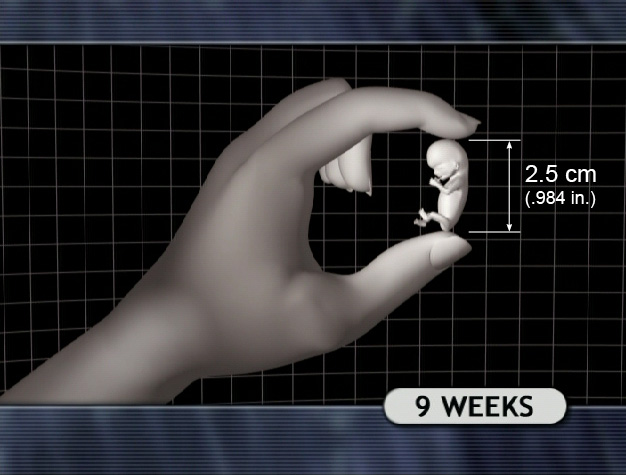 9 Week Fetus