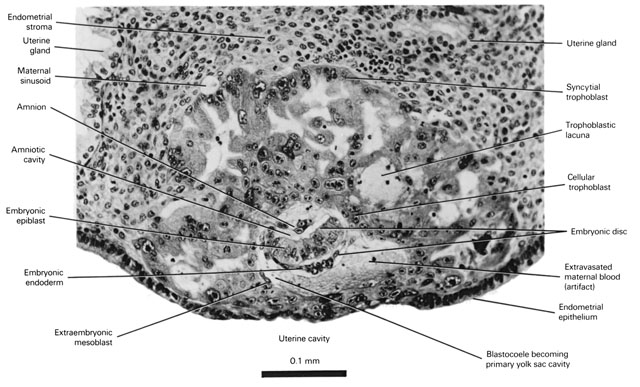 The 9-day previllous embryo (bilaminar blastocyst) Open PDF version of FIG 2-1, The 9-day previllous embryo bilaminar blastocyst