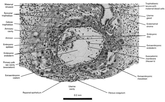 The 11-day previllous embryo (late bilaminar blastocyst) Open PDF version of FIG 2-2, The 11-day previllous embryo late bilaminar blastocyst