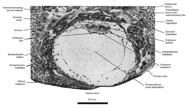 The 12-day embryo with primary villi (late bilaminar blastocyst) Open PDF version of FIG 2-4, The 12-day embryo with primary villi (late bilaminar blastocyst)