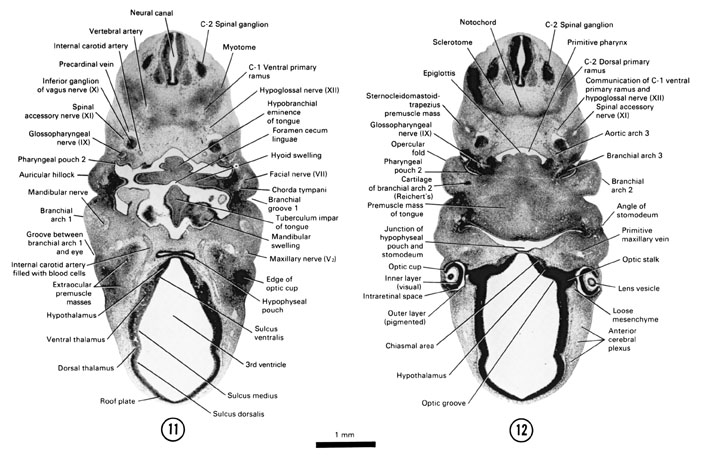 Open PDF version of FIG 6-11, A section through the C-2 spinal ganglion and dorsal surface of the tongue. A section through the premuscle mass of the tongue and the junction of the hypophyseal pouch with the stomodeum.