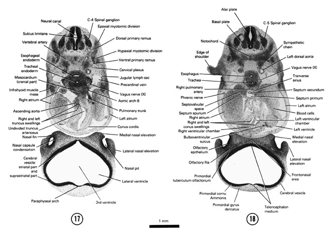 Open PDF version of FIG 6-14, A section through the truncus arteriosus of the heart and cerebral vesicle of the telencephalon. A section through the C-5 spinal ganglion and the conus swellings of the heart.