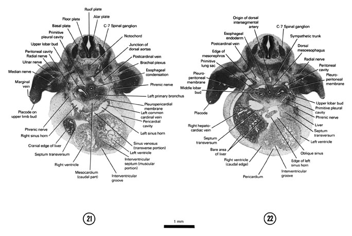 A section through the C-7 spinal ganglion and left sinus horn. A section through the pleuroperitoneal membrane and the cranial edge of the mesonephros. Open PDF version of FIG 6-16, A section through the C-7 spinal ganglion and left sinus horn. A section through the pleuroperitoneal membrane and the cranial edge of the mesonephros.