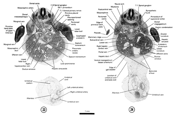 A section through the C-8 spinal ganglion and first rib primordium. A section through the T-1 spinal ganglion and stomach. Open PDF version of FIG 6-17, A section through the C-8 spinal ganglion and first rib primordium. A section through the T-1 spinal ganglion and stomach.