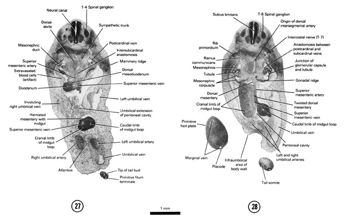 A section through the T-4 spinal ganglion, herniated midgut and tip of the tail bud. A section through the T-6 spinal ganglion and junction of the umbilical vessels with the ventral body wall. Open PDF version of FIG 6-19, A section through the T-4 spinal ganglion, herniated midgut and tip of the tail bud. A section through the T-6 spinal ganglion and junction of the umbilical vessels with the ventral body wall.