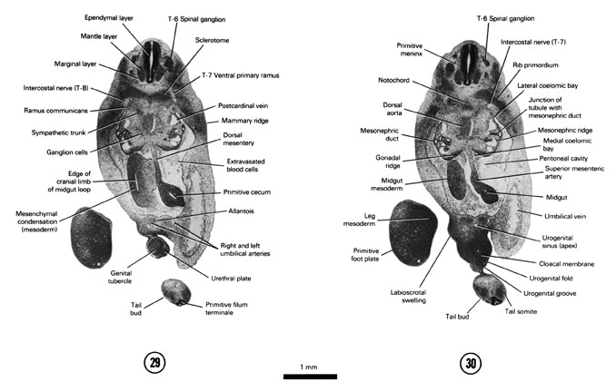 A section through the primitive cecum and genital tubercle. A section through the labioscrotal swelling and the urogenital groove and fold. Open PDF version of FIG 6-20, A section through the primitive cecum and genital tubercle. A section through the labioscrotal swelling and the urogenital groove and fold.
