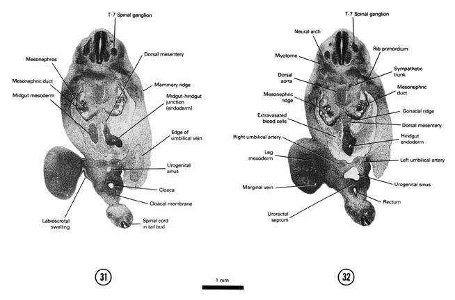 Open PDF version of FIG 6-21, A section through the T-7 spinal ganglion. A section through the urogenital sinus, rectum and urorectal septum.