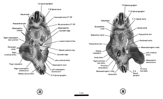 A section through the T-8 and S-5 spinal ganglia. A section through the T-9 and S-4 spinal ganglia. Open PDF version of FIG 6-23, A section through the T-8 and S-5 spinal ganglia. A section through the T-9 and S-4 spinal ganglia.