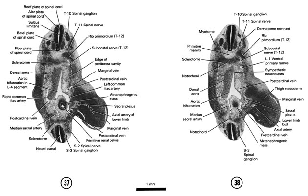 Open PDF version of FIG 6-24, A section through the T-10 and S-3 spinal ganglia. A section through the origin of the median sacral artery.