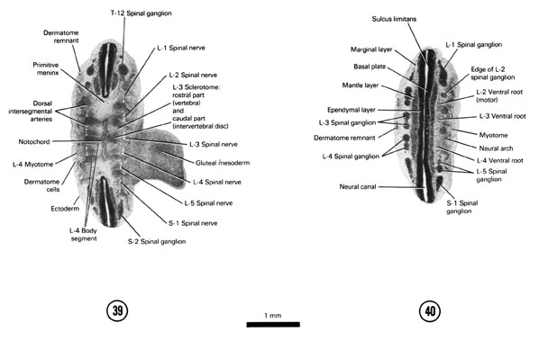 A section through the T-12 and S-2 spinal ganglia. A section through the L-1 to S-1 spinal ganglia. Open PDF version of FIG 6-25, A section through the T-12 and S-2 spinal ganglia. A section through the L-1 to S-1 spinal ganglia.