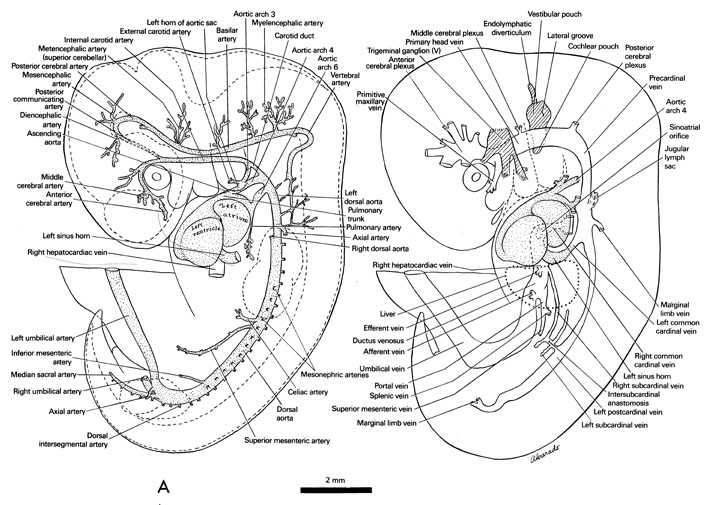 Cardiovascular system of the 10-mm embryo. Open PDF version of FIG 6-5, Cardiovascular system of the 10-mm embryo.