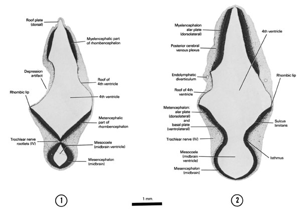 A section through the roof of the fourth ventricle and origin of the trochlear nerve. A section through the mesencephalic isthmus and tip of the endolymphatic diverticulum. Open PDF version of FIG 6-6, A section through the roof of the fourth ventricle and origin of the trochlear nerve. A section through the mesencephalic isthmus and tip of the endolymphatic diverticulum.