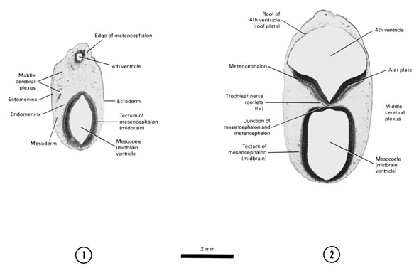 Open PDF version of FIG 7-6, A section through the tectum of the mesencephalon and edge of the metencephalon. A section through the dorsal part of the mes- and metencephalon junction.