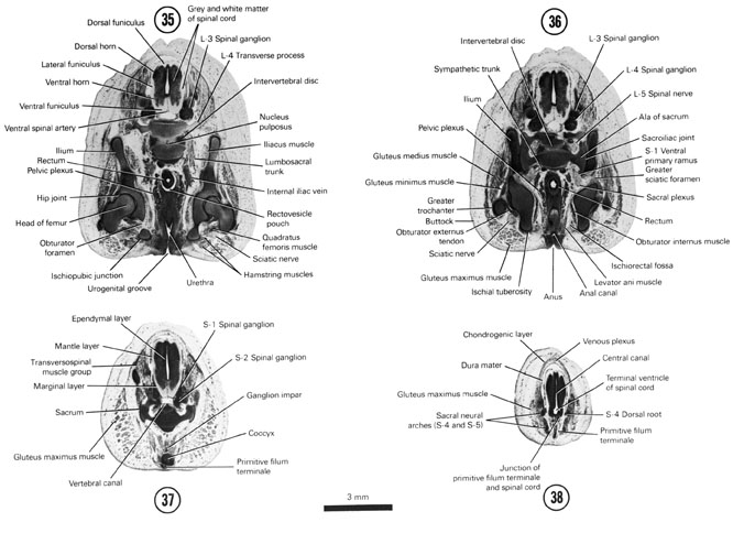 A section through the hip joint and L-3 spinal ganglion. A section through the anus, anal canal, caudal part of the rectum and L-3 and L-4 spinal ganglia. A section through the coccyx and S-1 and S-2 spinal ganglia. A section through the terminal ventricle of the central canal. Open PDF version of FIG 8-20, A section through the hip joint and L-3 spinal ganglion. A section through the anus, anal canal, caudal part of the rectum and L-3 and L-4 spinal ganglia. A section through the coccyx and S-1 and S-2 spinal ganglia. A section through the terminal ventricle of the central canal.
