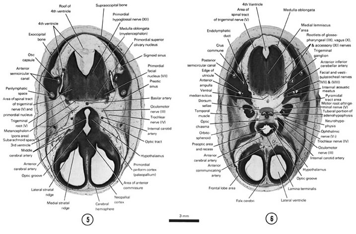 A section through the cerebral hemispheres, hypothalamus, metencephalon and medulla oblongata. A section through the cerebral hemispheres (frontal lobe area), hypothalamus and medulla oblongata. Open PDF version of FIG 8-5, A section through the cerebral hemispheres, hypothalamus, metencephalon and medulla oblongata. A section through the cerebral hemispheres (frontal lobe area), hypothalamus and medulla oblongata.