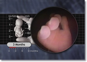 Fetal Hand Hand of the 3 month fetus.