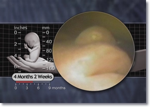 Fetus Lips and Nose 4 months 2 weeks fetus, lips, Nose