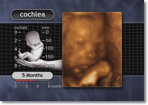 3D ultrasound 5 month fetus 5 month fetus cochlea, ear