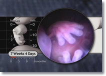 Fingers of the 7 weeks 4 days embryo. Fingers of the 7 weeks 4 days embryo.