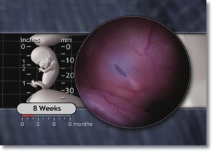 Eyelids Fuse eyelids fuse, 8 week embryo