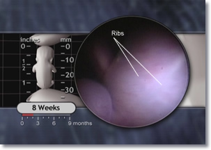 Embryo Ribs Embryo Ribs, 8 weeks