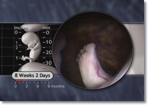 8 weeks 2 day Fetus Foot, Feet