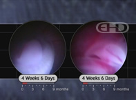 See Labels [Upper and Lower Limb Buds]