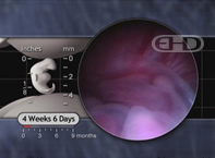 See Labels [The Lower Embryo]