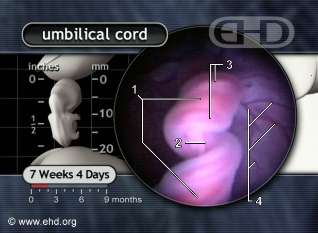 Close-up, Umbilical Cord at 7½ Weeks [Click for next image]