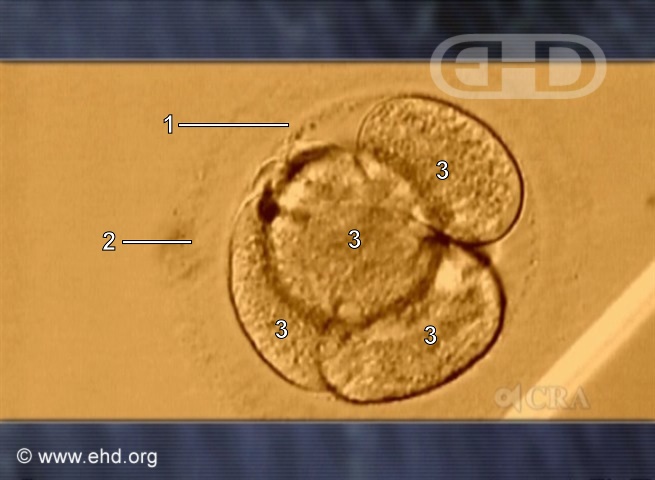 Four-Cell Human Embryo [Click for next image]