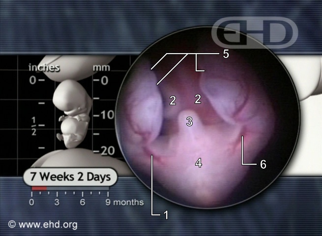 Lower Embryo at 7 Weeks, 2 Days [Click for next image]