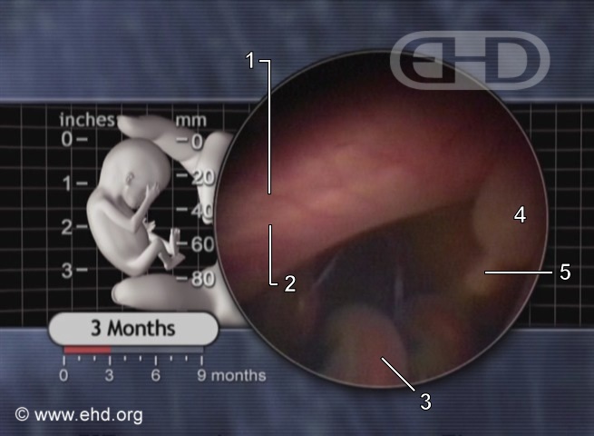 Posterior Surface of Left Thigh [Click for next image]