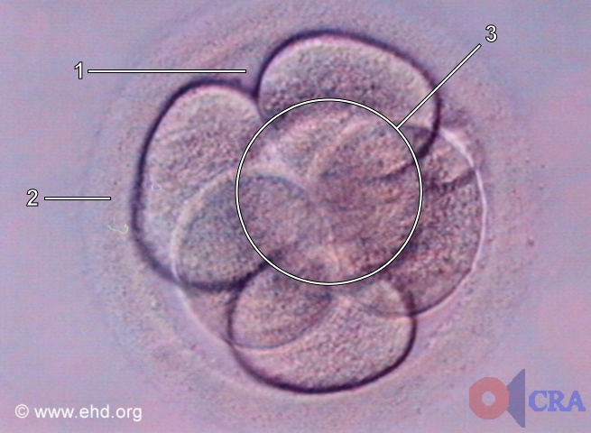 Six-Cell Embryo [Click for next image]