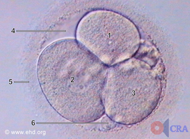Three-Cell Embryo [Click for next image]