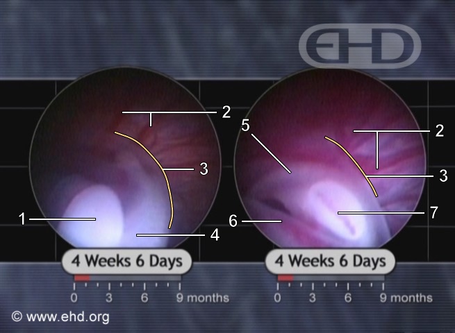 Upper and Lower Limb Buds [Click for next image]