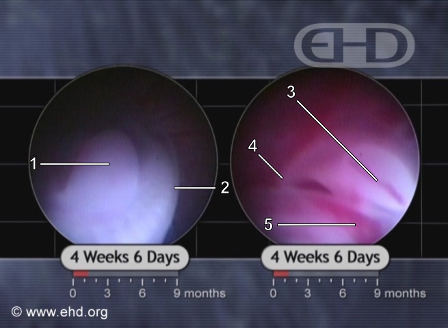 Upper and Lower Limb Buds [Click for next image]