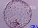 Free Blastocyst  (without zona)