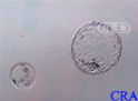 Hatched Blastocyst