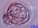 Hatching Blastocyst