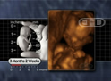 The 14-Week Fetus
